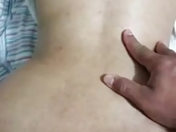 In anal prolapse haadha manaa, harma haadha manaa.